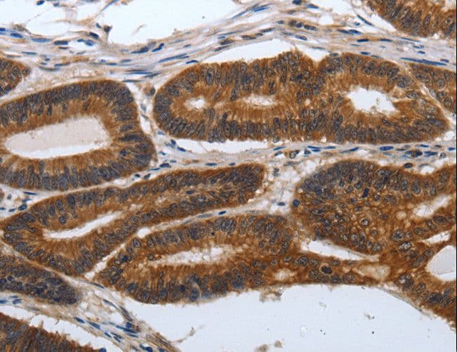 PDCD7 Antibody