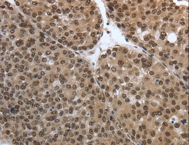 SMAD7 Antibody