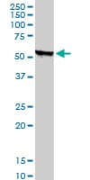 Monoclonal Mouse anti-Human STK38 Antibody (clone 2G8-1F3, IHC, IF, WB)