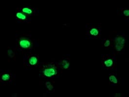 UNG / Uracil DNA Glycosylase Antibody (clone OTI2F8)