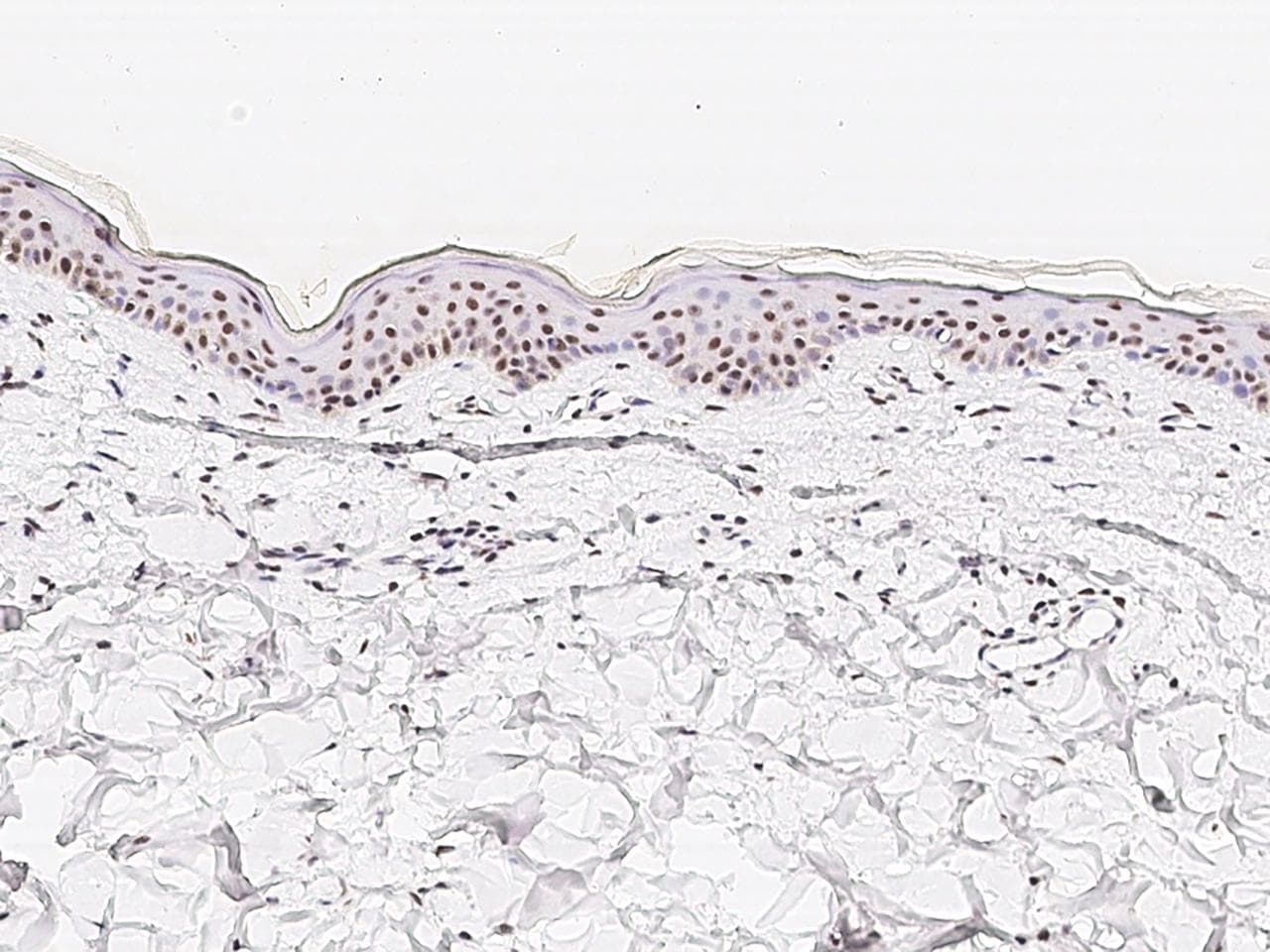 Polyclonal Rabbit anti-Human NR2C2 / TAK1 Antibody (Preservative Free, IHC, IF)