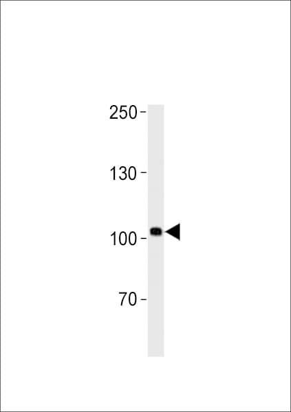 Polyclonal Rabbit anti-Zebrafish HEG1 Antibody (aa691-717, WB)