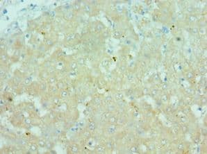 CTCFL / BORIS Antibody (aa1-270)