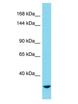 MYOM3 Antibody (aa274-323)