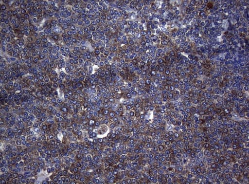 RPL10 / Ribosomal Protein L10 Antibody (clone OTI9A8)