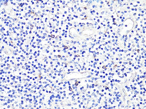 CD86 Antibody
