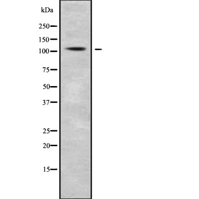 IGHMBP2 Antibody