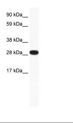 ZFP36L1 Antibody (aa46-95)