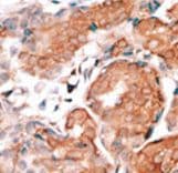 GCAP / GUCA1A Antibody (aa160-191)
