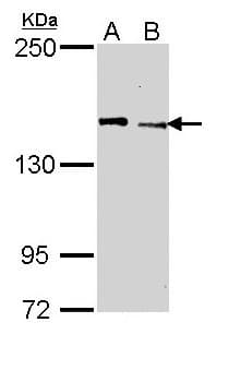 KDM5C / Jarid1C / SMCX Antibody