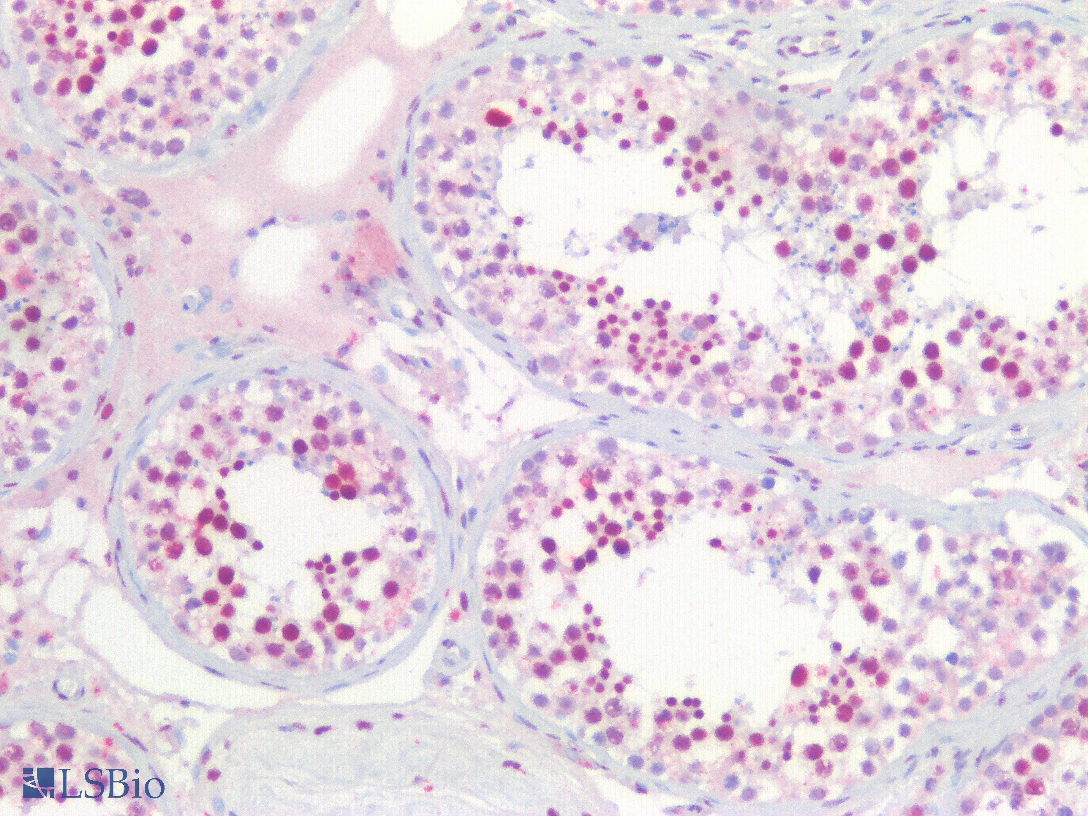 IHC-plus™ Polyclonal Goat anti-Human NPM1 / NPM / Nucleophosmin Antibody (aa281-294, IHC, WB)