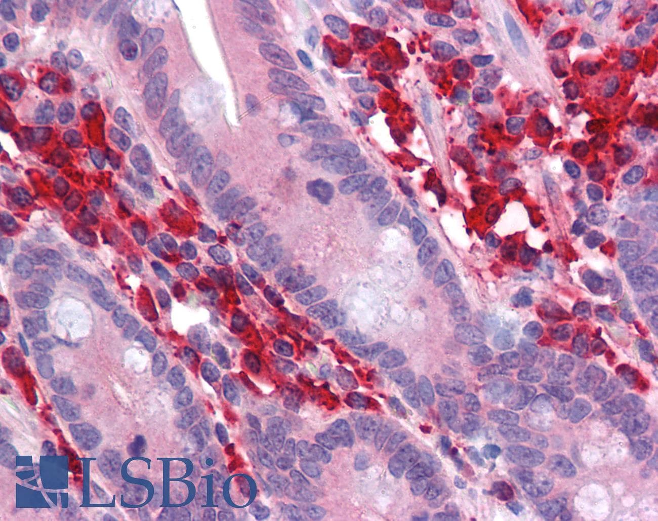 IHC-plus™ LRIT3 Antibody (clone 3E7)