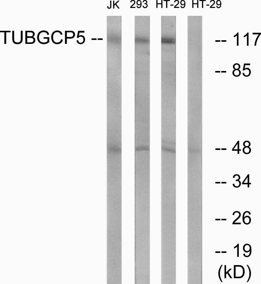 TUBGCP5 / GPC5 Antibody