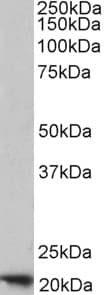 IHC-plus™ Polyclonal Goat anti-Human FTH1 / Ferritin Heavy Chain Antibody (aa221-232, IHC, WB)