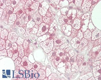 IHC-plus™ Polyclonal Rabbit anti-Human UBE2S / E2 EPF Antibody (aa183-210, IHC, WB)