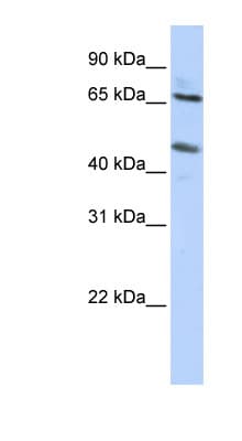 SLC26A10 Antibody (N-Terminus)