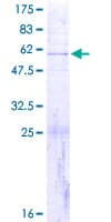 Human MRPS7 Protein (Recombinant GST)