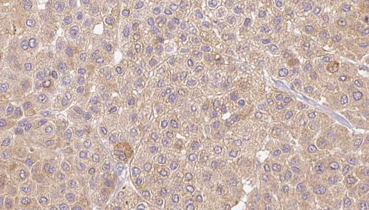 IL36A Antibody