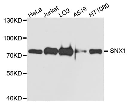Polyclonal Rabbit anti-Human SNX1 Antibody (WB)