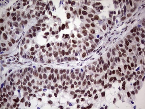 Monoclonal Mouse anti-Human ERCC1 Antibody (clone OTI2H1, IHC, WB)