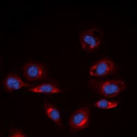 COL4A6 / Collagen IV Antibody (C-Terminus)