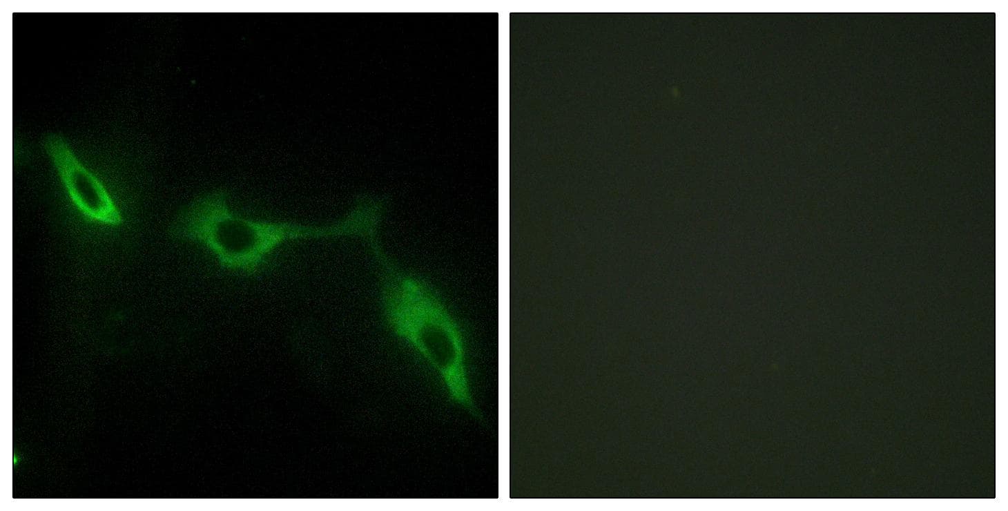LGALS9 / Galectin 9 Antibody