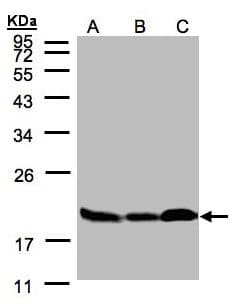 PathPlus™ STMN1 / Stathmin / LAG Antibody