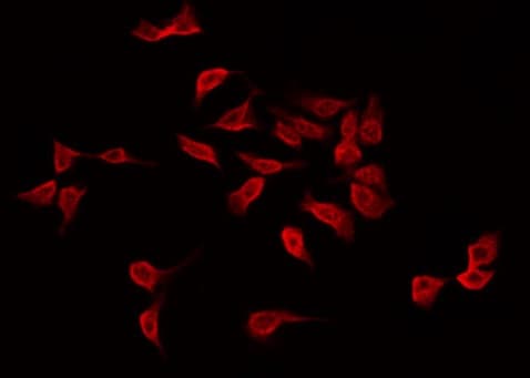 CAPN11 / Calpain 11 Antibody