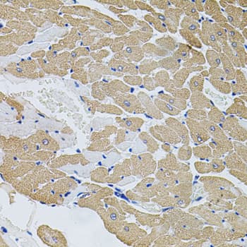CAST / Calpastatin Antibody