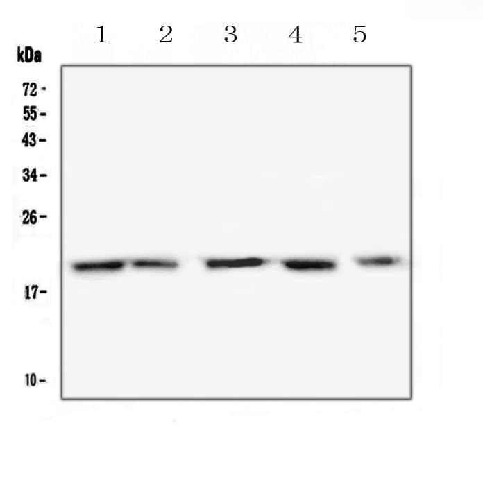 Polyclonal Rabbit anti-Mouse TNFRSF17 / BCMA Antibody (WB)