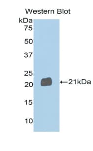 SEMA4B / Semaphorin 4B Antibody (aa192-367)