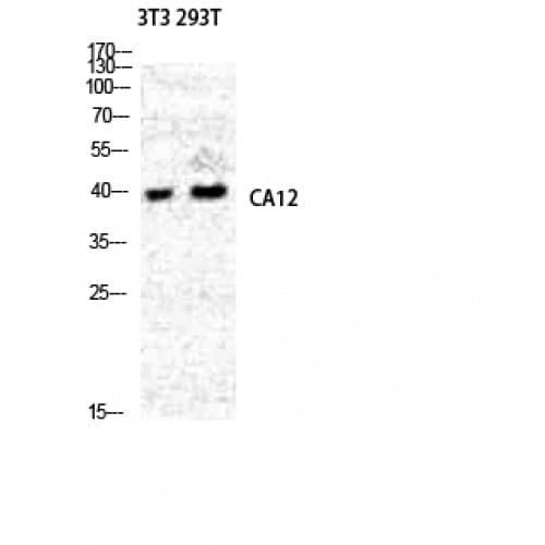 Polyclonal Rabbit anti-Human CA12 / Carbonic Anhydrase XII Antibody (200-280 aa, Internal, WB)