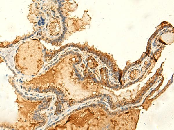 KIAA0513 Antibody