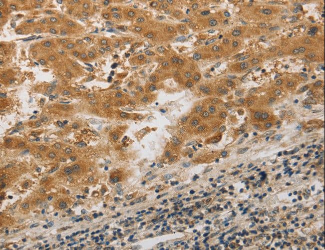PIBF1 / PIBF Antibody