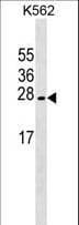 LZIC Antibody (aa81-109)