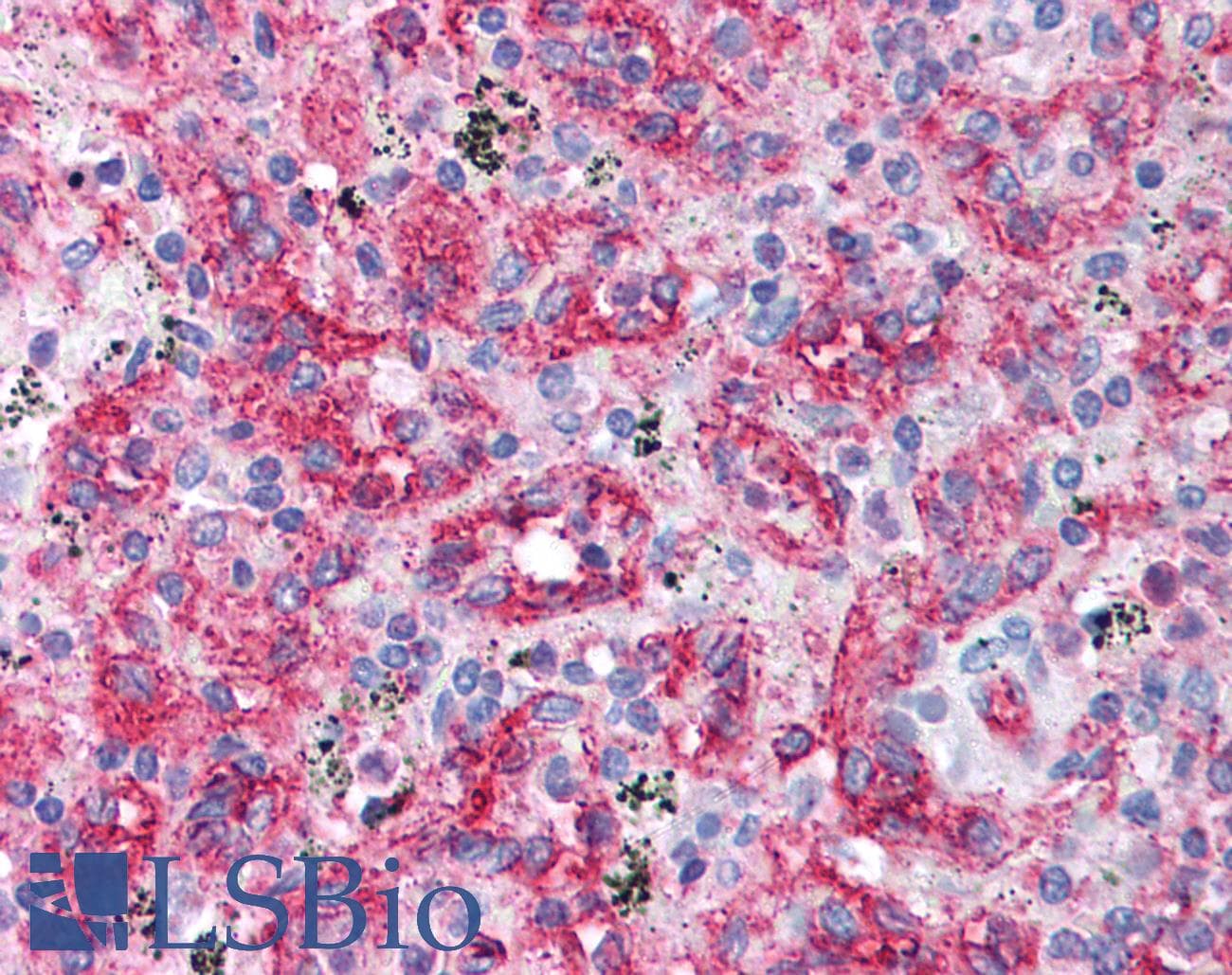 IHC-plus™ CD36 Antibody (aa300-400)