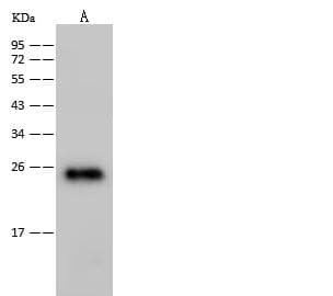 HIV-1 p24 Antibody