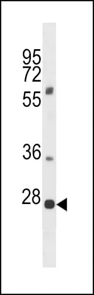 PLEKHF1 Antibody (aa51-79)