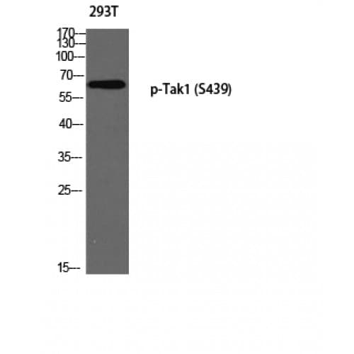 MAP3K7 / TAK1 Antibody (380-460 aa)