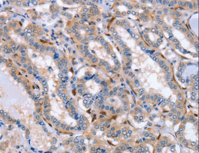 Latexin / MUM Antibody