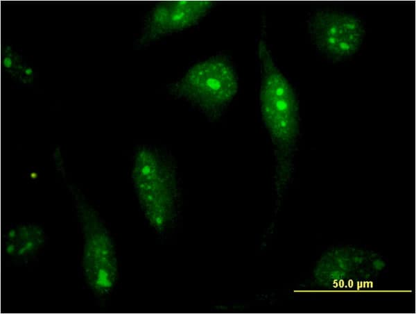 CAPN15 / SOLH Antibody (clone 4E2)