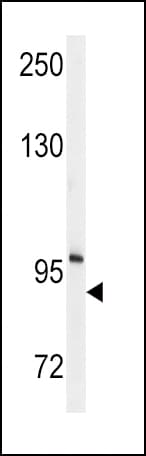 ENPP2 / Autotaxin Antibody (aa401-430)