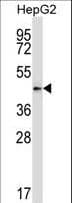 Polyclonal Rabbit anti-Mouse PDK2 Antibody (aa78-107, IHC, WB)
