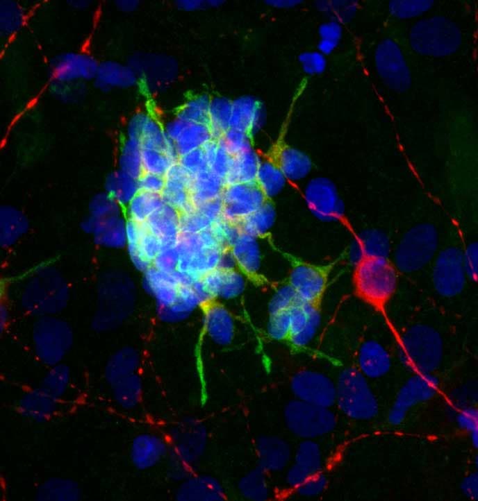 DCX / Doublecortin Antibody (clone 3E1)