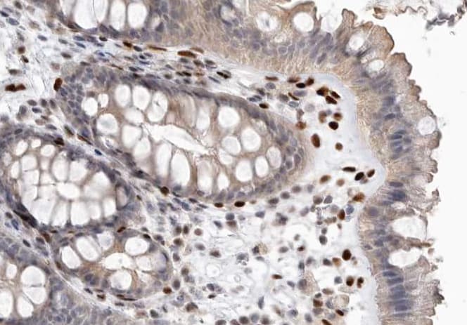 PTEN Antibody (phospho-Ser370)