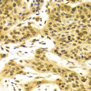 ELAVL1 / HUR Antibody