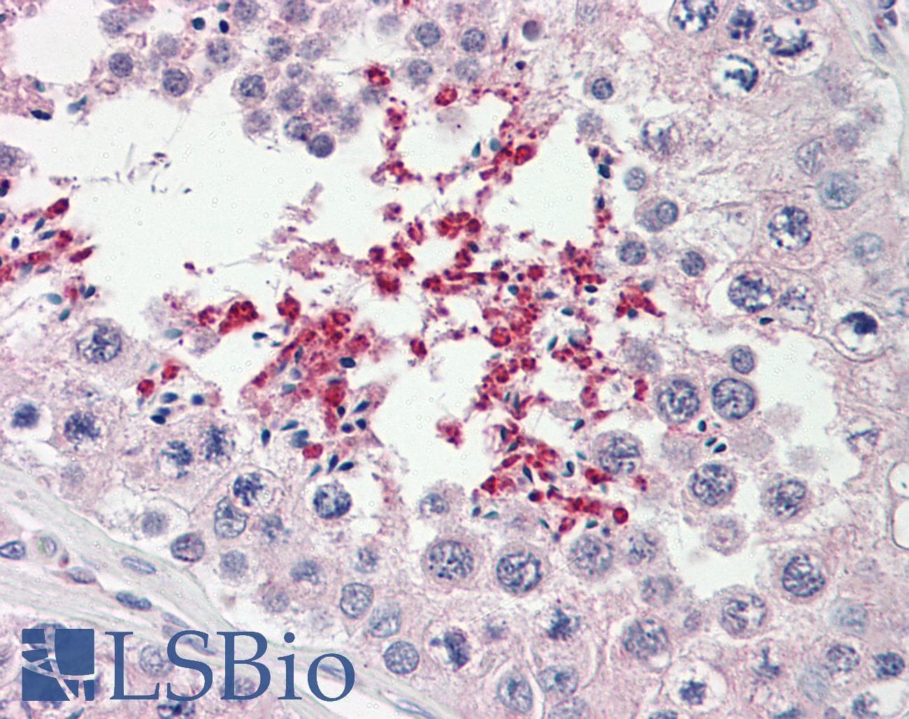 ABCD2 / ALDR Antibody