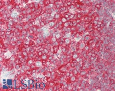BCHE / Cholinesterase Antibody (aa29-150)
