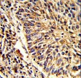 ADAM9 Antibody (aa704-733)