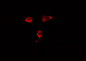RABEP2 Antibody